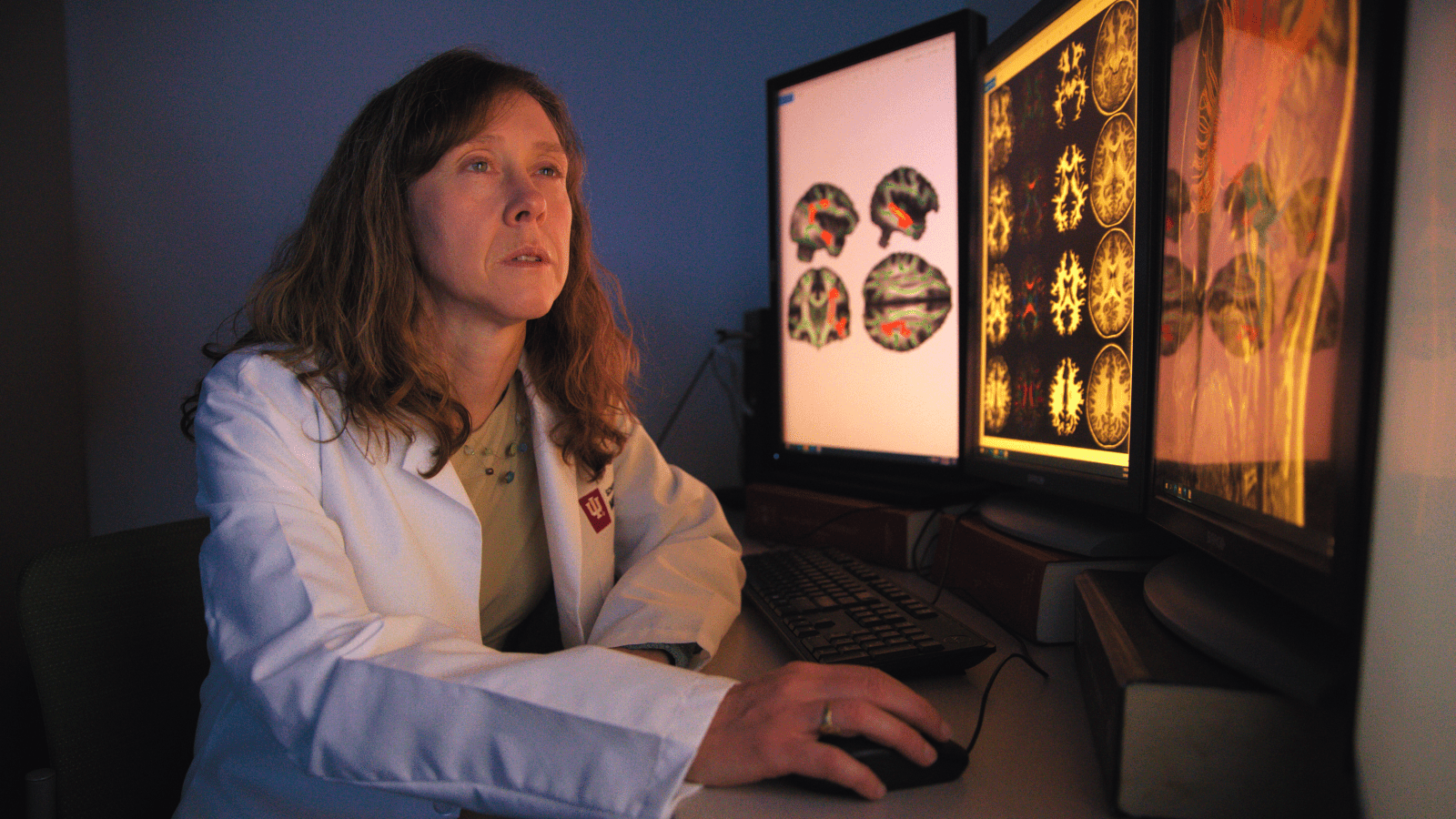 Brenna McDonald reviewing brain scans on a monitor.