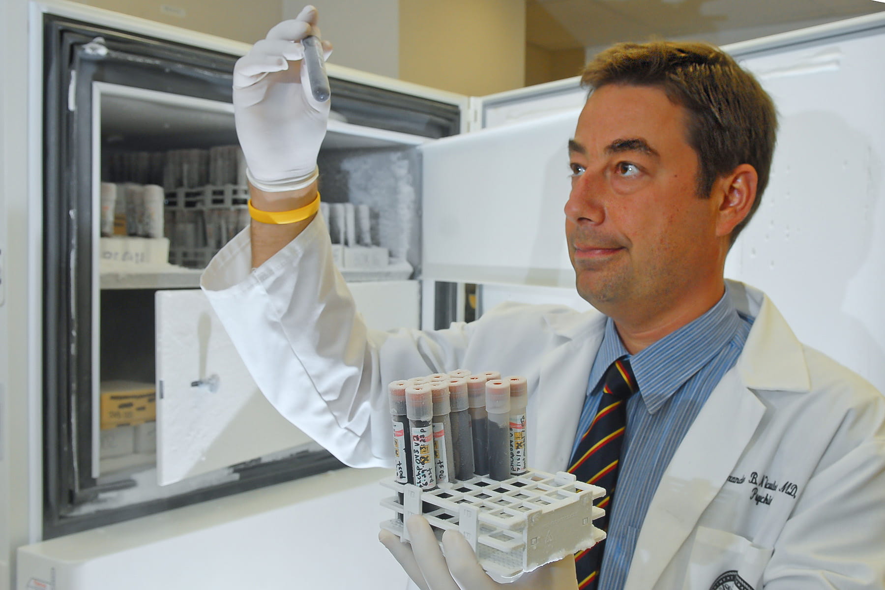 Niculescu Alexander test tube Niculescu Alexander test tube