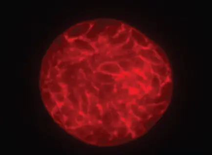 toxoplasma-tissue-cyst