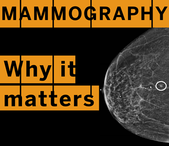 Mammography Radiology (4) Mammography Radiology (4)