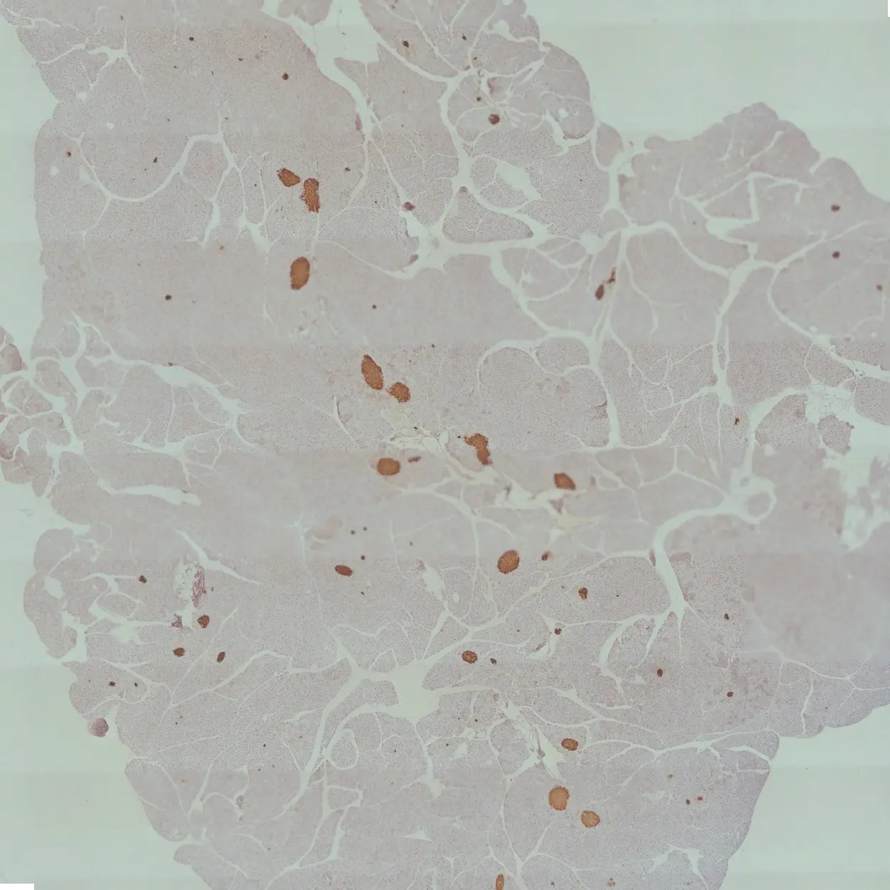 An image taken from a microscope. 