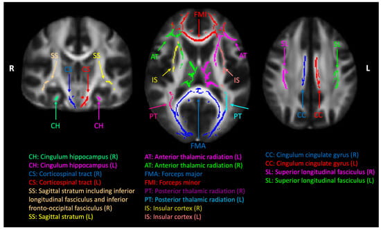 Cerebral white-matter tract regions of interest (ROIs). A common white-matter skeleton was first generated by the tract-based spatial statics (TBSS) toolbox in the FMRIB Software Library (FSL) using normalized diffusion tensor imaging (DTI) factional anisotropy maps from all the subjects. The white-matter skeleton was intercepted with Johns Hopkins University (JHU) white-matter tract atlas, and eighteen ROIs were used in this study.