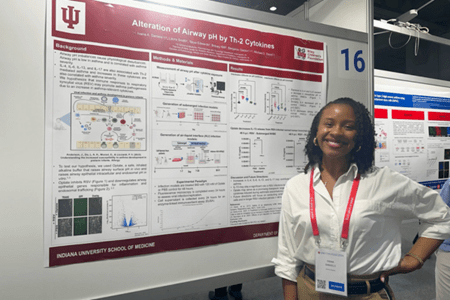 Ivana Daniels, PhD student at IU School of Medicine, standing next to her research poster at the European Respiratory Society (ERS) Congress in Vienna, Austria on September 9, 2024.