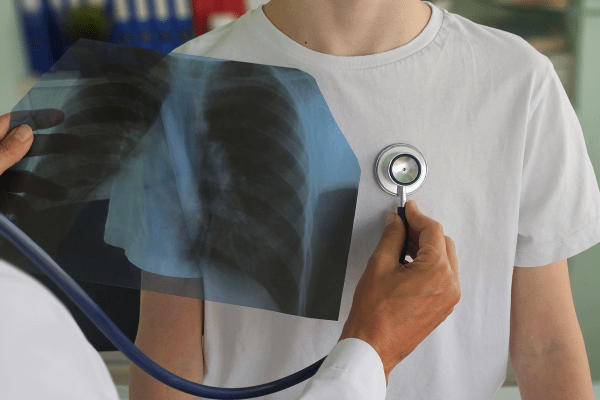 Stock image of a doctor checking a patient's lungs while examining an x-ray of the lungs