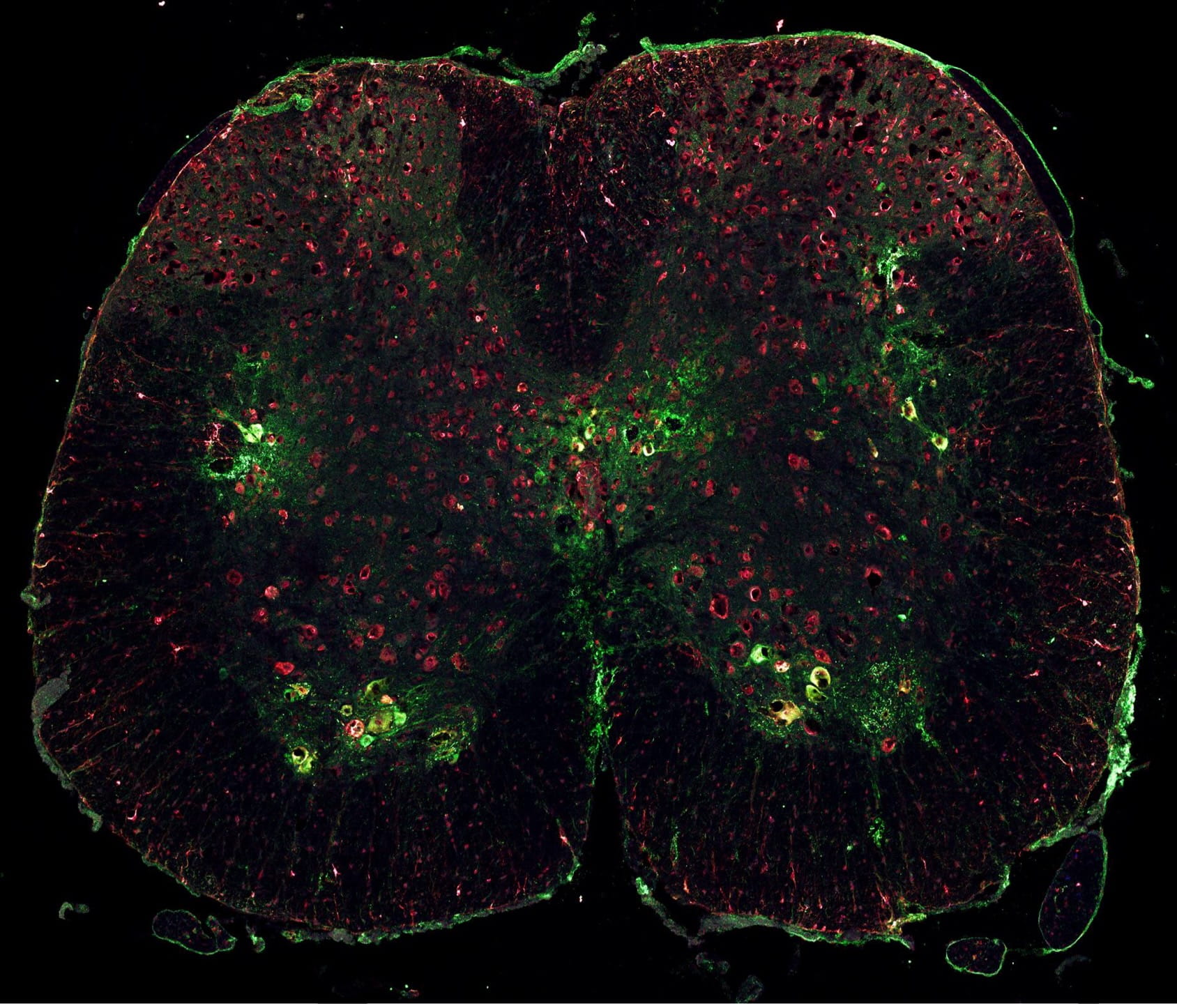 Cross section image of the spinal cord in ALS mouse model with green indicating neurons and red indicating proteins involved with ALS