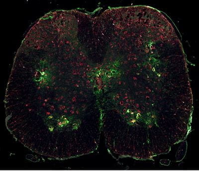 Cross section image of the spinal cord in ALS mouse model with green indicating neurons and red indicating proteins involved with ALS