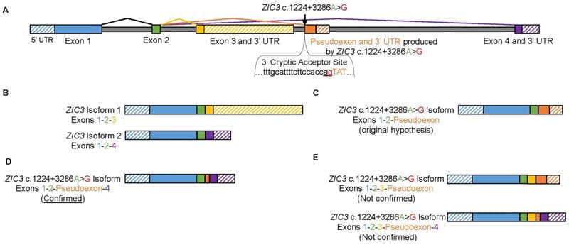 genetic sequencing in ZIC3