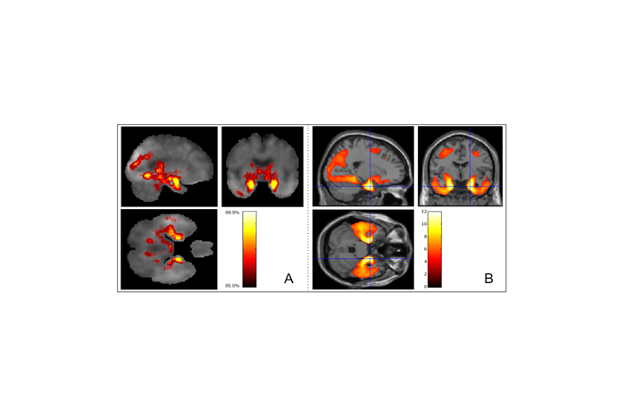 (PMID: 33371874, DOI: 10.1186/s12859-020-03848-0) (Taeho Jo, et al. (2020), https://doi.org/10.1186/s12859-020-03848-0)