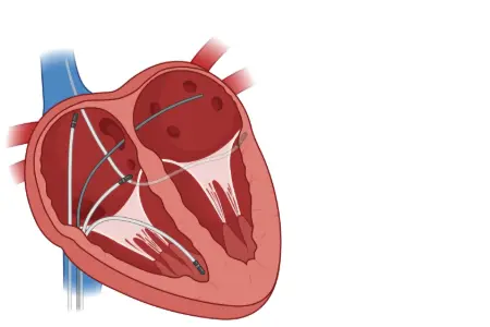 Animated arrhythmia and electrophysiology icon showing electrical system of the heart organ. 