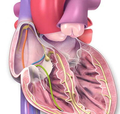 Electrical system of human heart.