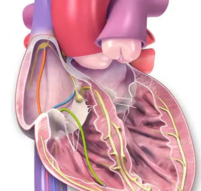 Electrical system of human heart. 