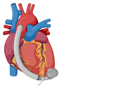 Animated heart failure icon - left justified.