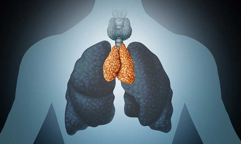 This illustration shows cancer growth in the thymus, a lymphoid organ of the immune system.
