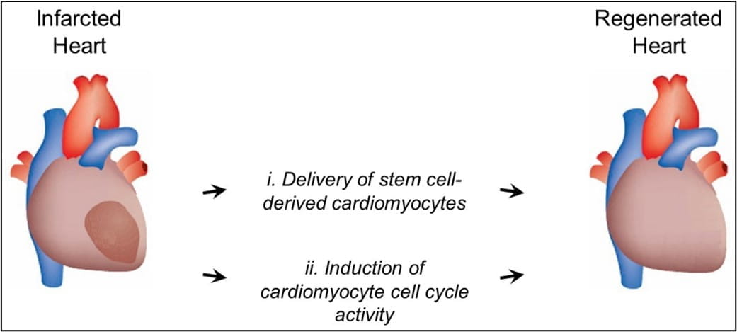 Illustration of infarcted heart and regenerated heart, showing the process of the delivery of stem cell-derived cardiomyocytes and induction of cardiomyocyte cell cycle activity.