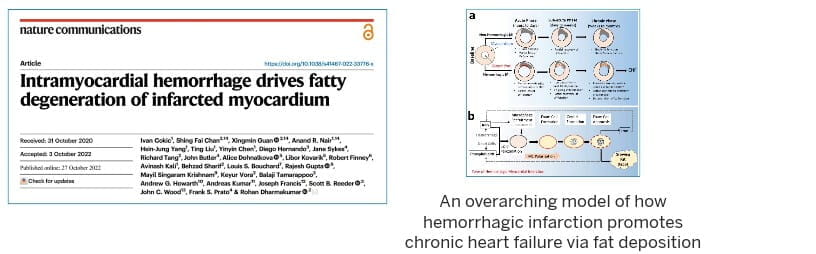 graphic from this publication shows an overarching model of how hemorrhagic infarction promotes chronic heart failure via fat deposition