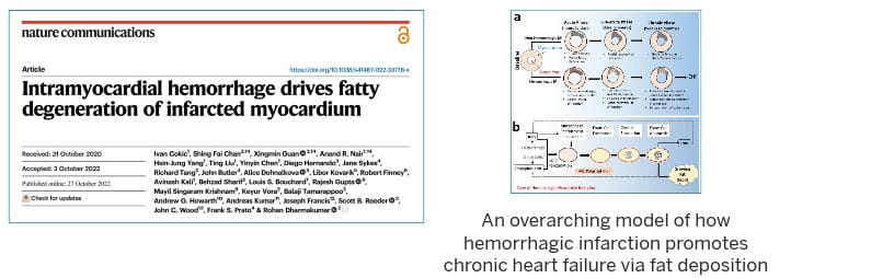 graphic from this publication shows an overarching model of how hemorrhagic infarction promotes chronic heart failure via fat deposition