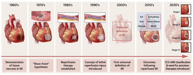 The illustration showcases benchmarks in heart attack tissue damage research by decade between 1960 and 2020