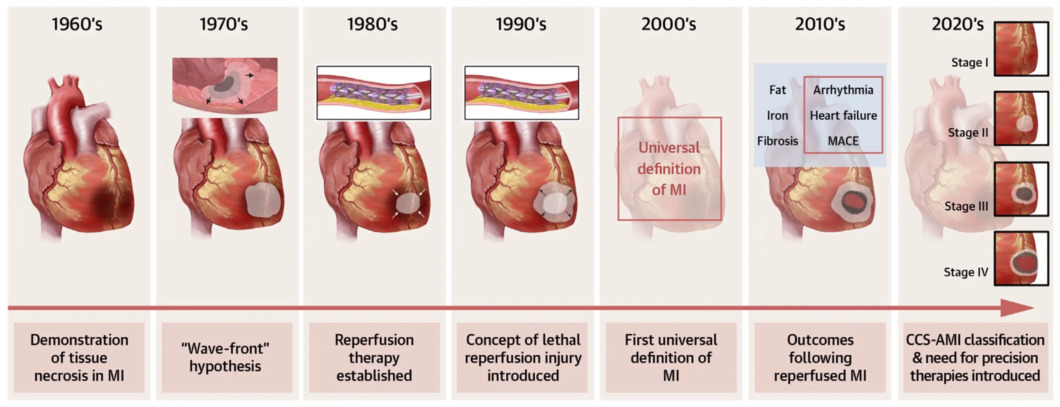 The illustration showcases benchmarks in heart attack tissue damage research by decade between 1960 and 2020