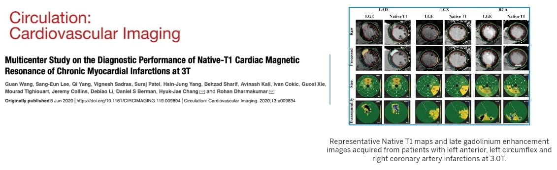 graphic from this publication shows representative native T1 maps and late gadolinium enhancement images from patients with left anterior, left circumflex nad right coronary artery infarctions at 3.0T