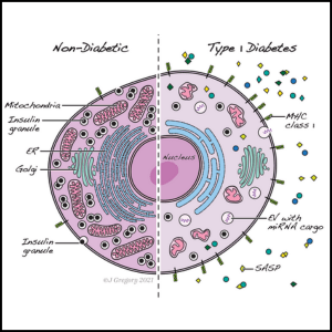 graphic showing healthy vs. sick beta cell