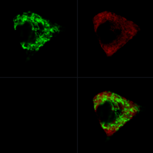 Micrograph of the rat insulinoma-derived pancreatic β cell  expressing gene-encoded ER calcium indicator (Red) and Mitochondrial calcium indicator (Green). Cells were treated with 15 mM glucose. Magnification = 400X.