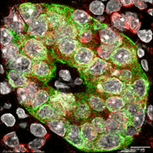 microscope image of pre-mirR-155/Insulin/DAPI