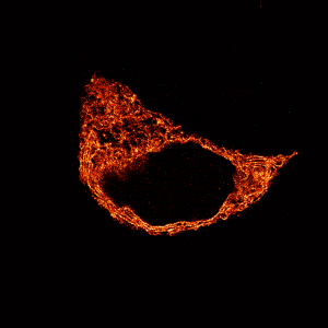 Representative super-resolution image of the rat insulinoma-derived pancreatic β cell line with the endoplasmic reticulum labeled using a Sec61β-GFP plasmid and GFP-Booster Alexa Fluor 647 nanobody (shown in orange). Scale bar = 5 micrometers.