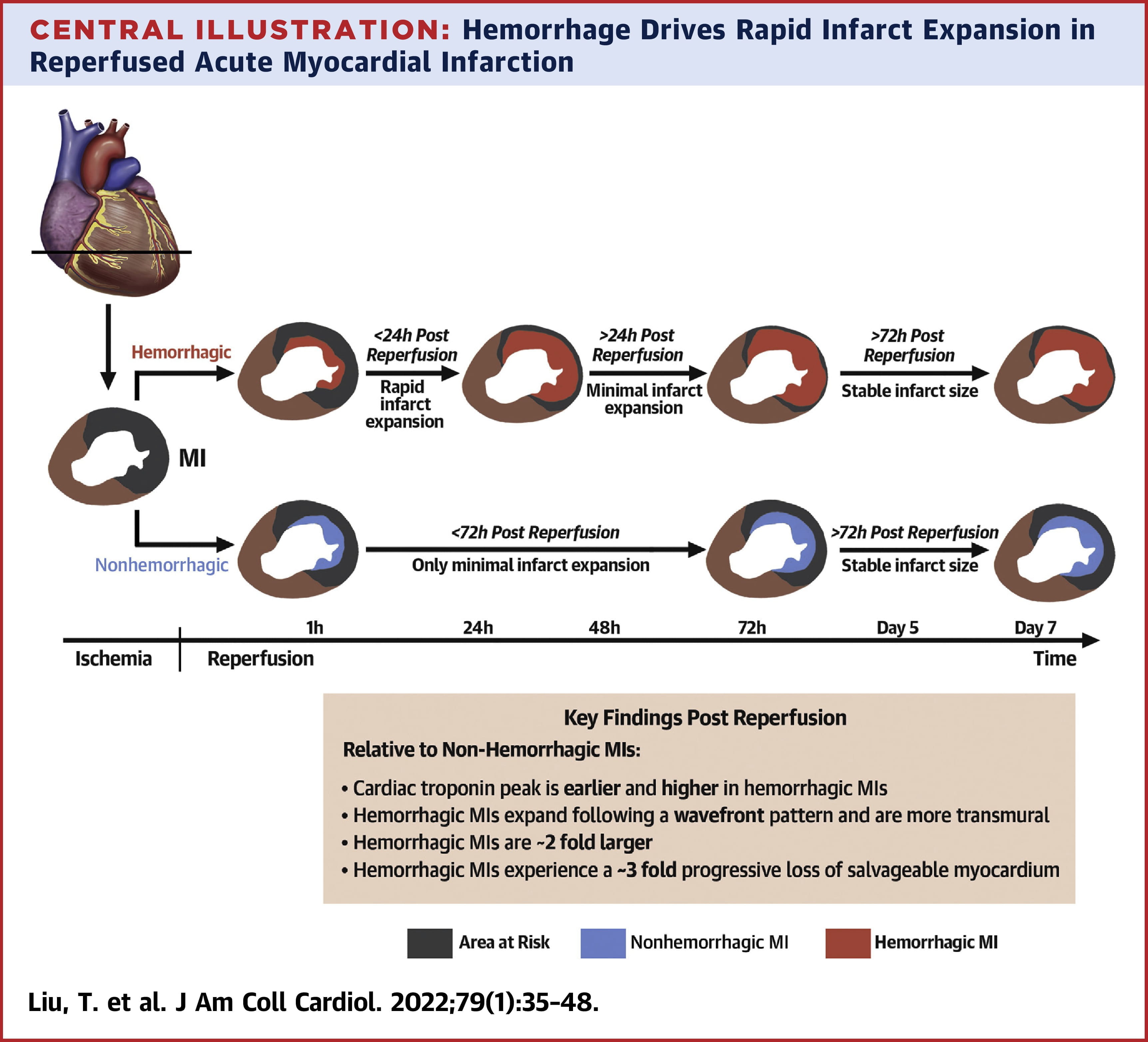 Influence of Myocardial Hemorrhage on Staging of Reperfused Myocardial Infarctions With T2 Cardiac Magnetic Resonance Imaging: Insights Into the Dependence on Infarction Type With Ex Vivo Validation