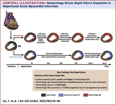 Influence of Myocardial Hemorrhage on Staging of Reperfused Myocardial Infarctions With T2 Cardiac Magnetic Resonance Imaging: Insights Into the Dependence on Infarction Type With Ex Vivo Validation