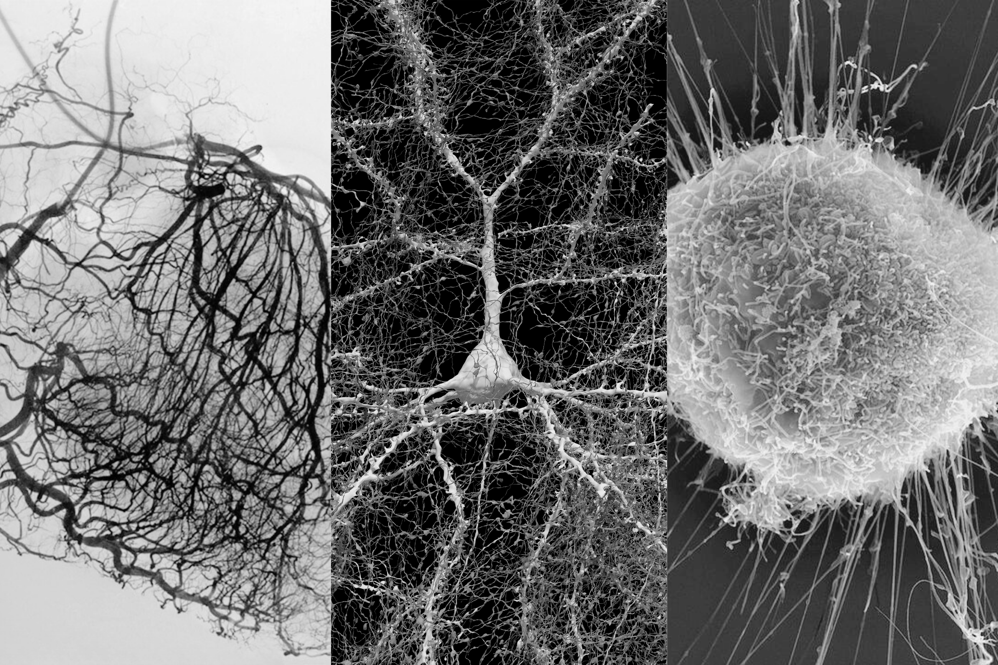 An image collage featuring three images in a row: the vascular system of the heart, neural pathways of the brain, and a tumor.