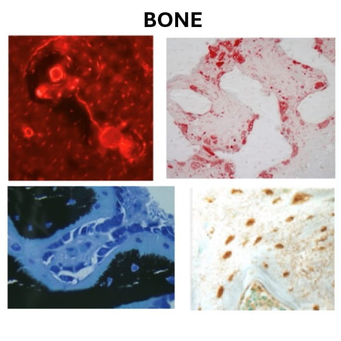 bone histology examples