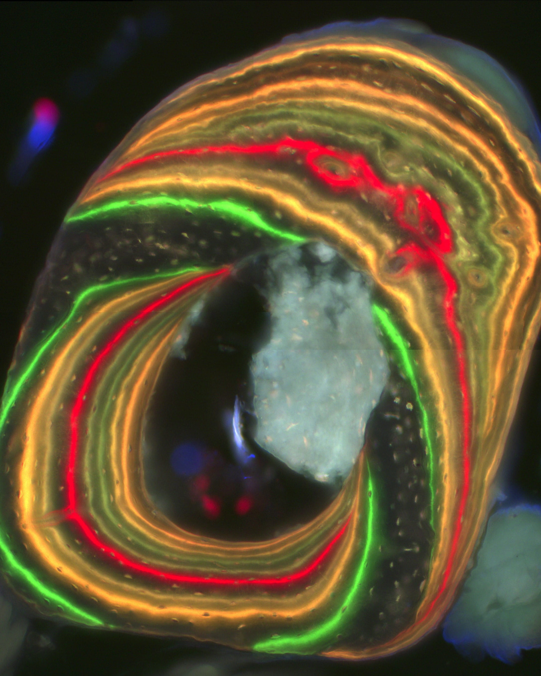 red and yellow histology sample