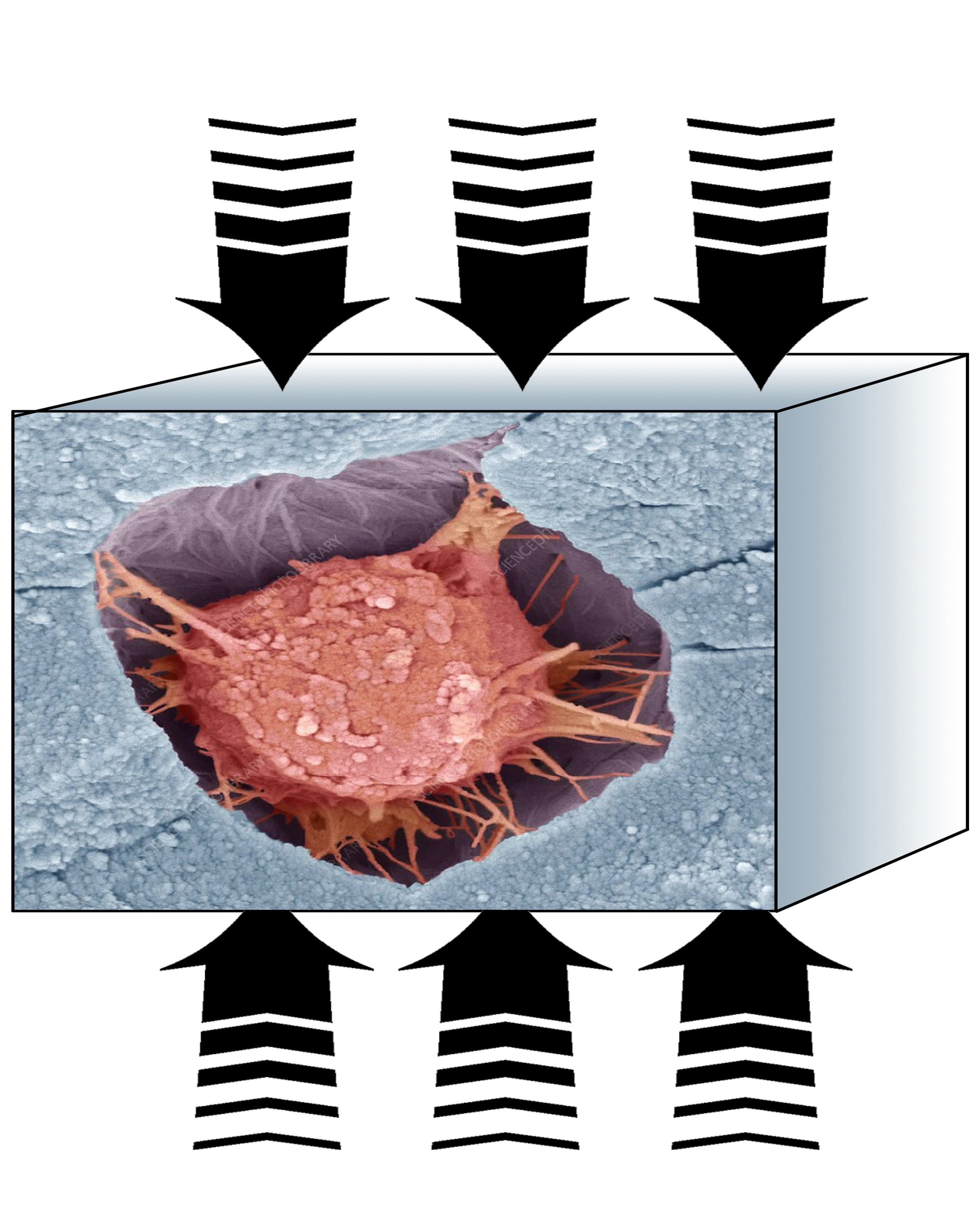 illustration of pressure exerted on bone
