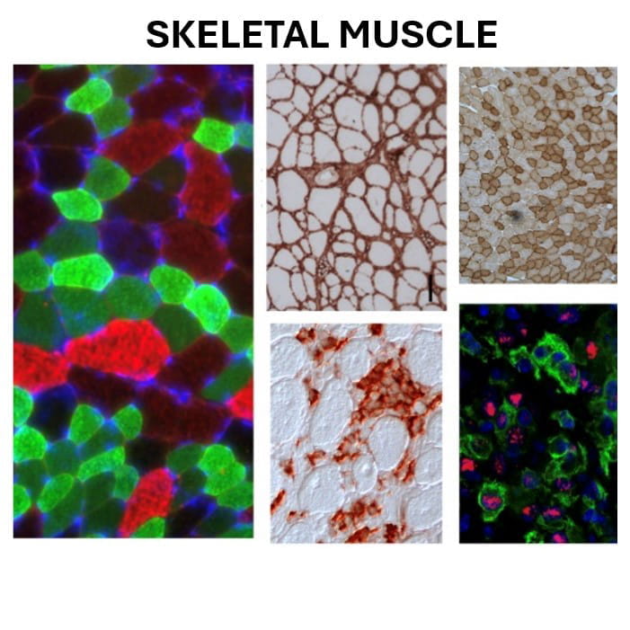 skeletal muscle examples