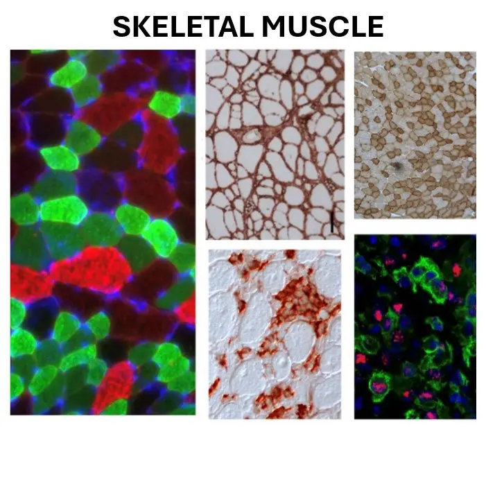 skeletal muscle examples
