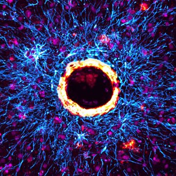Astrocytes