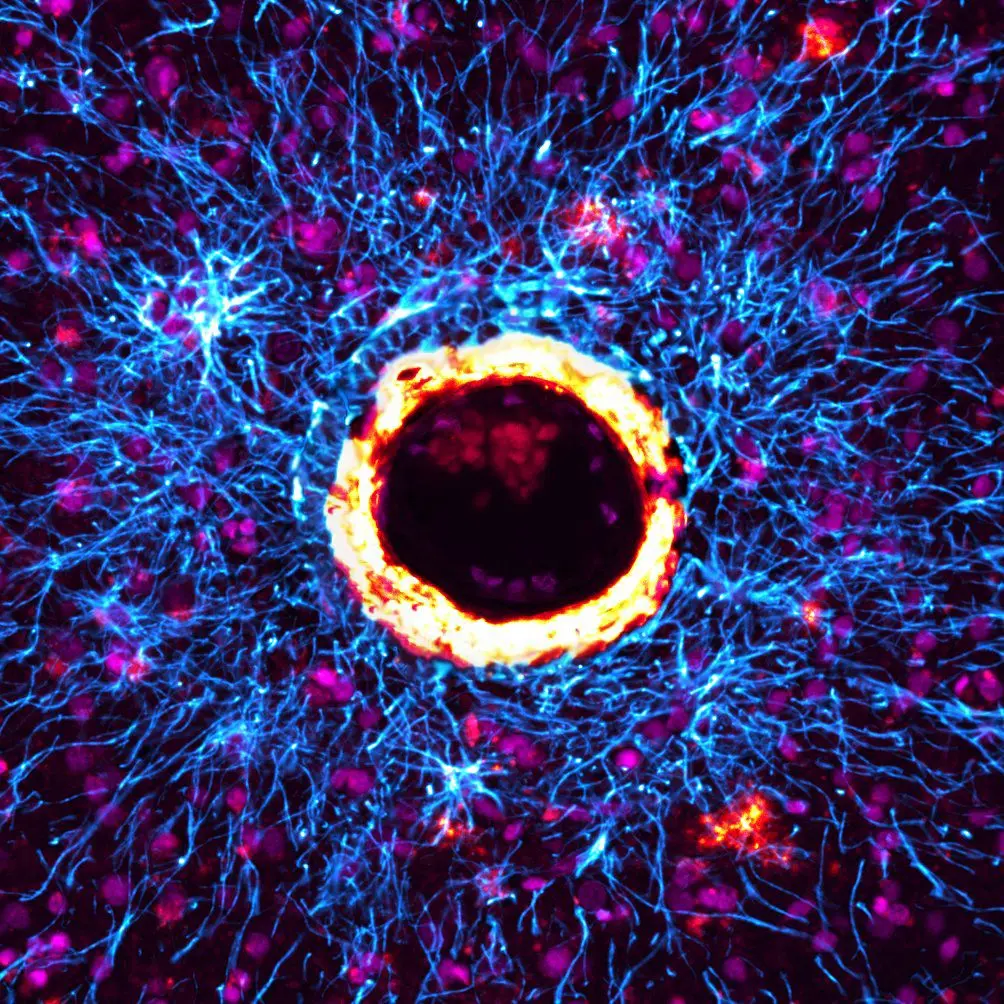 Astrocytes