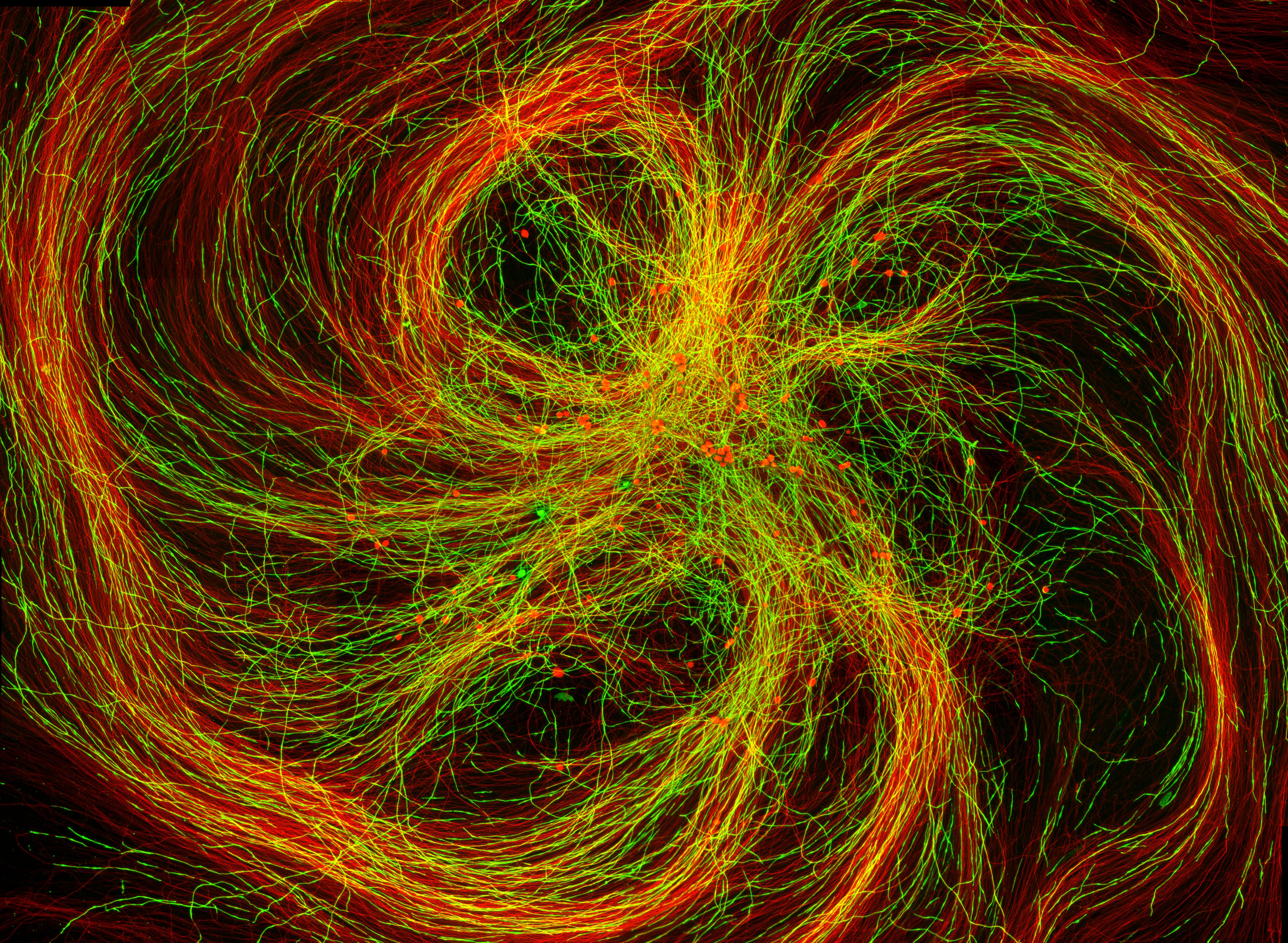 Yellow green and orange swirling image titled ""Myelin in a Dish""
