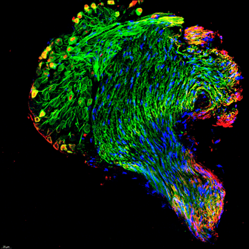 regenerating cells