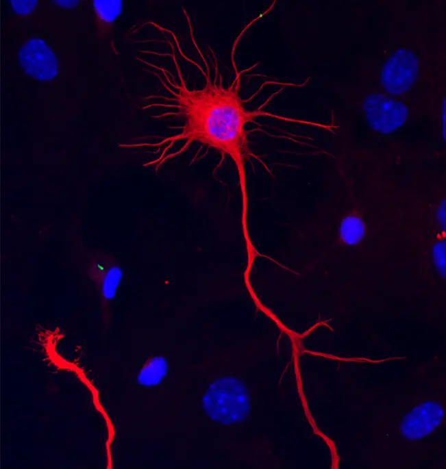 An image of a neuron