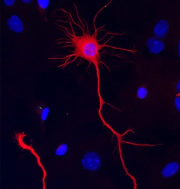 An image of a neuron