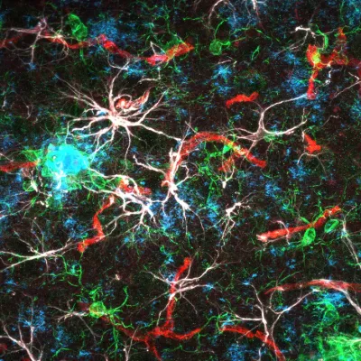 A fluorescent confocal microscopy 63x image of the cortex from an 18-month-old humanized amyloid mouse model