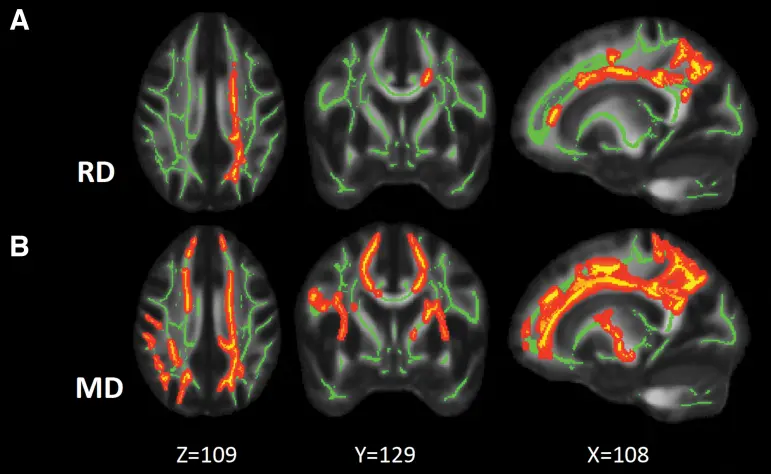 MRI image