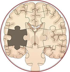 Illustration of the brain