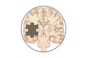 neurodegenerative disorders