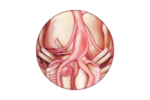 neurovascular center