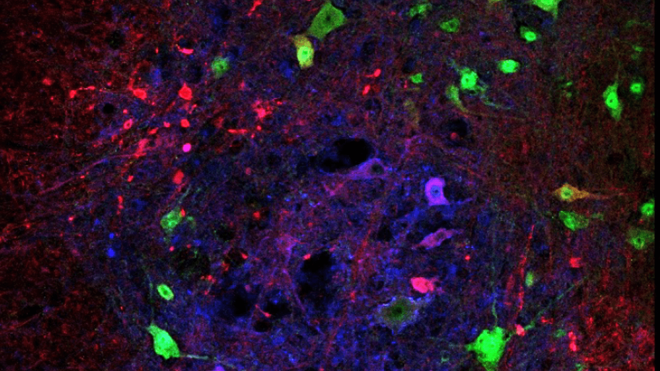 an image from a microscope