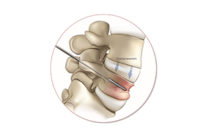 an illustration of the spine
