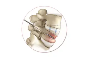 an illustration of the spine