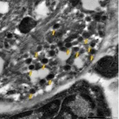 Transmission electron microscopy (TEM) imaging: high electron density vesicles (yellow arrows) typical of catecholamine-containing chromaffin cells found in cardiomyocytes